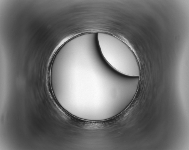 X0000087601187200704271038