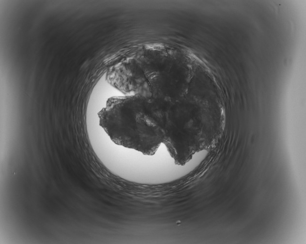 X0000087601395200704271035