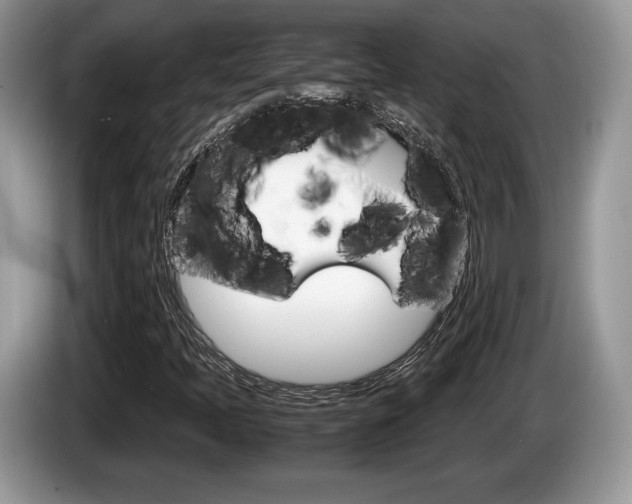 X0000087601397200704271035