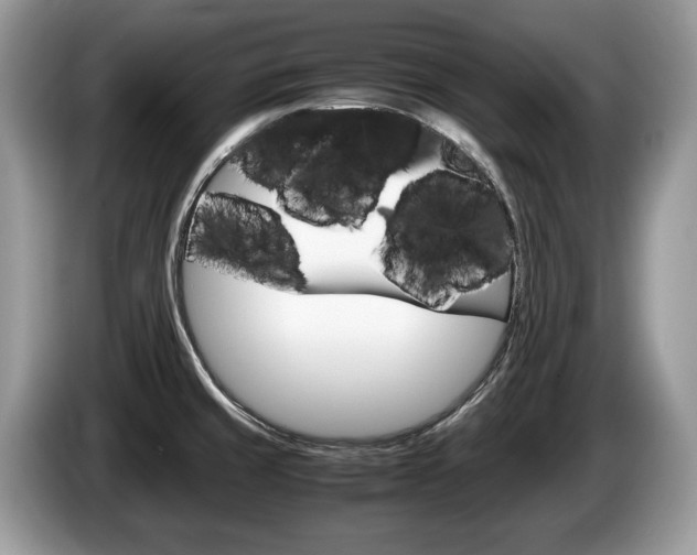 X0000087601429200704271035