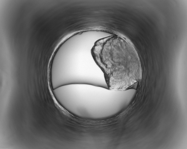 X0000087601439200704271035
