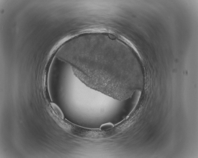 X0000087601179200704271325
