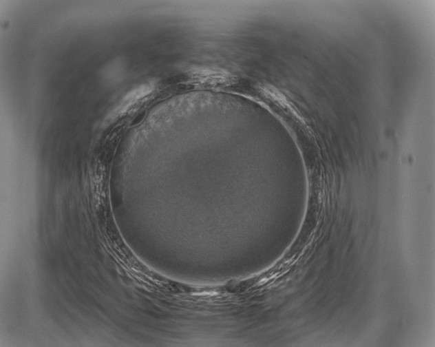 X0000087601399200704271320