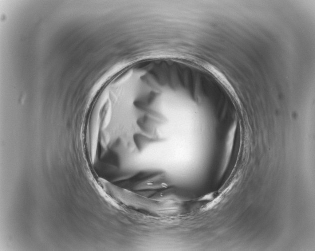 X0000087601197200705112320