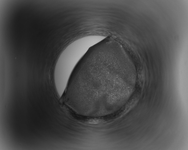 X0000087600708200705181237