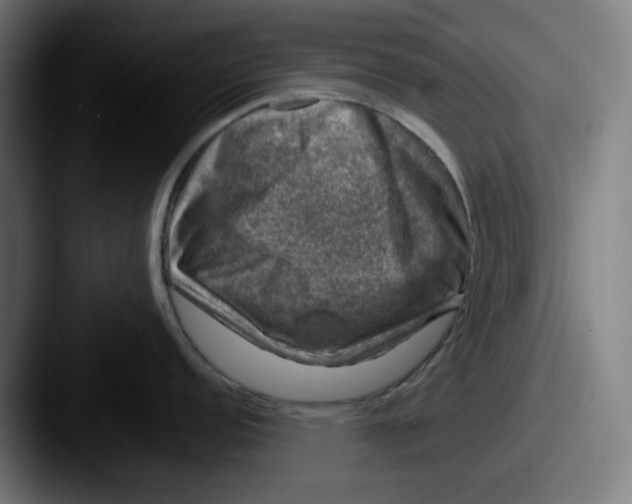 X0000087601152200705181233