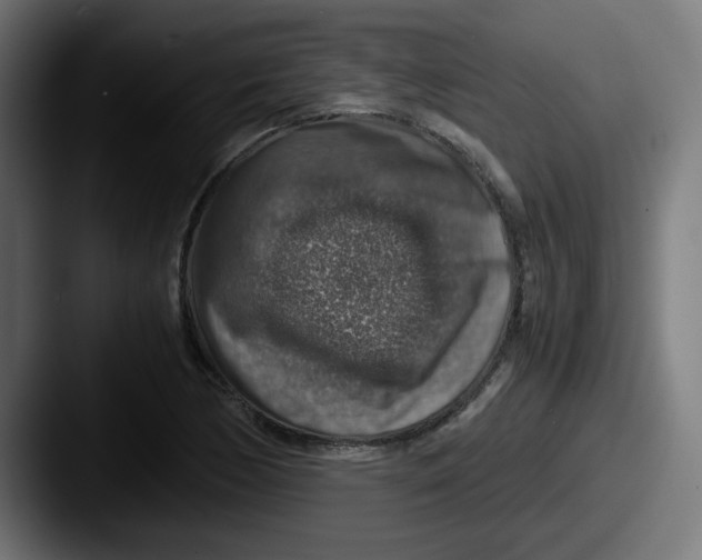X0000087601170200705181232