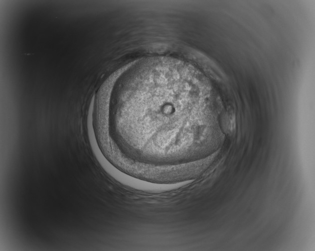X0000087601204200705181231