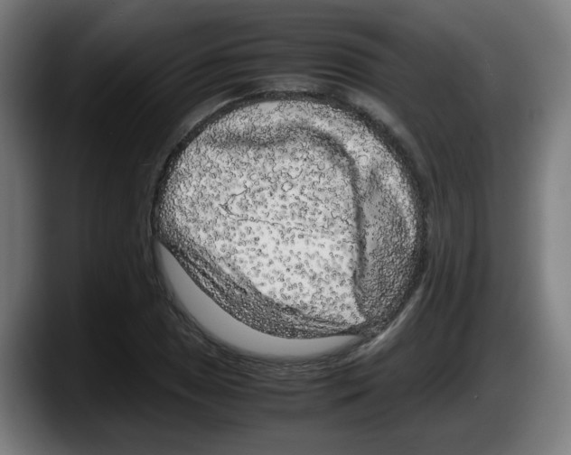 X0000087601025200705251918