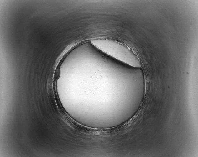 X0000087610147200704271107