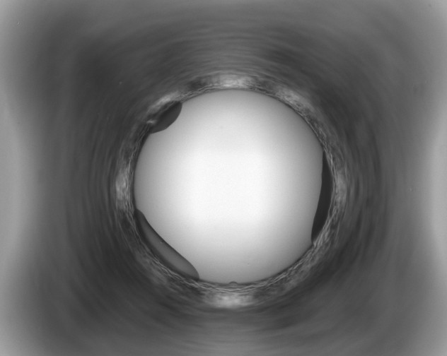 X0000087610360200704271105
