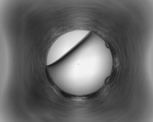 X0000087610664200704271102