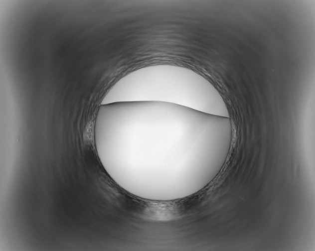 X0000087610713200704271101