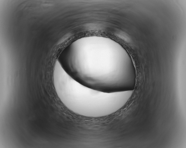 X0000087610869200704271059