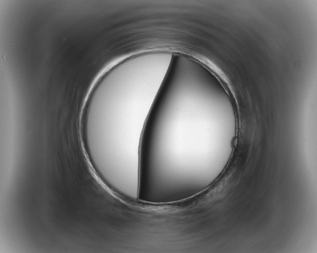 X0000087611045200704271057