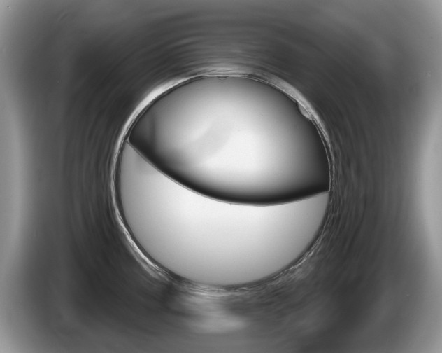 X0000087611195200704271055