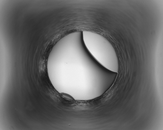X0000087611204200704271055