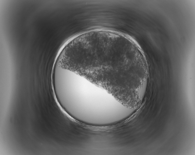 X0000087611247200704271055