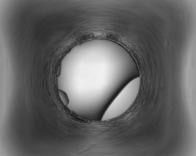 X0000087611249200704271055