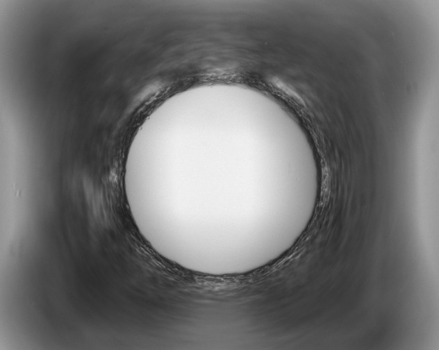 X0000087611254200704271054