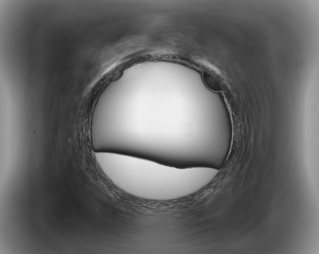 X0000087611255200704271054