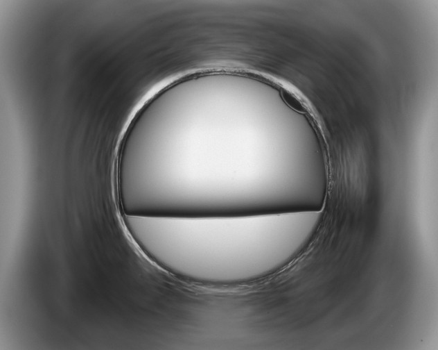 X0000087611295200704271054