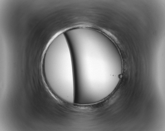 X0000087611375200704271053
