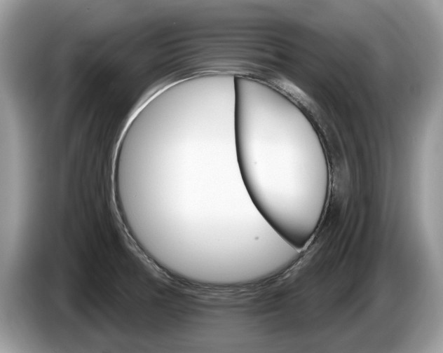 X0000087611378200704271053