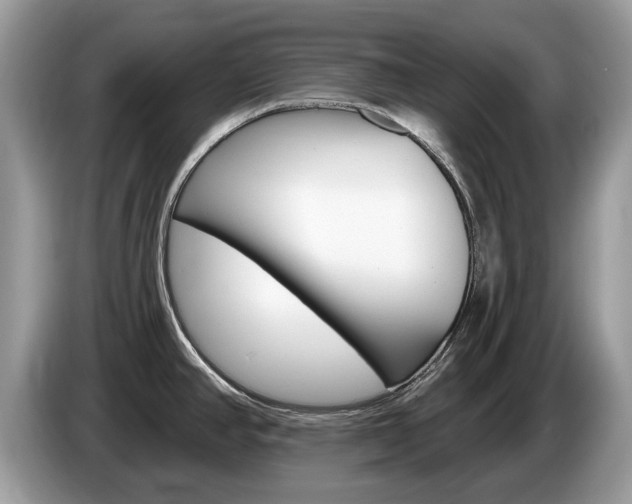 X0000087611390200704271053