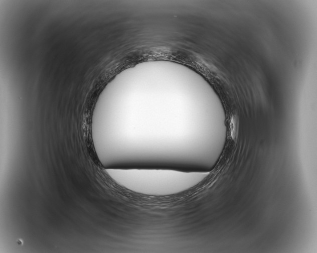 X0000087611395200704271052