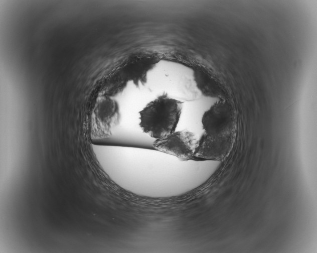 X0000087611397200704271052