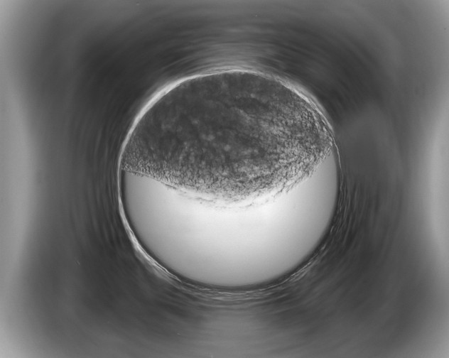 X0000087611439200704271053