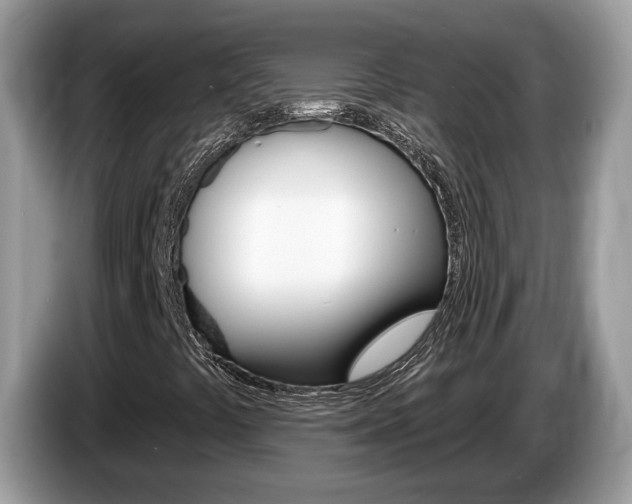 X0000087611441200704271052