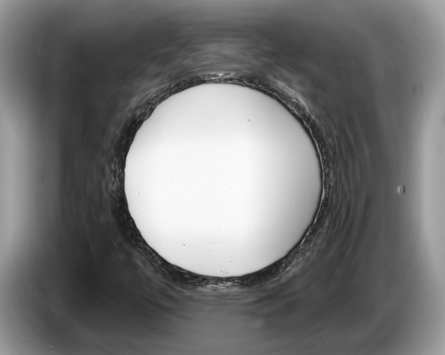 X0000087611447200704271052