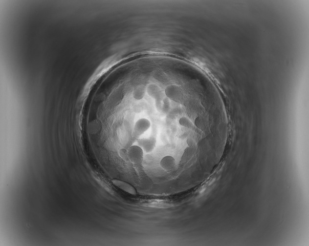 X0000087610151200704271347