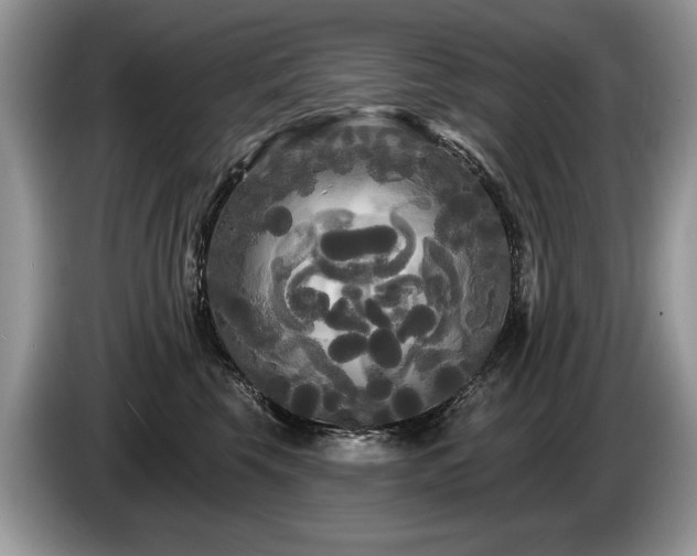 X0000087610569200704271343