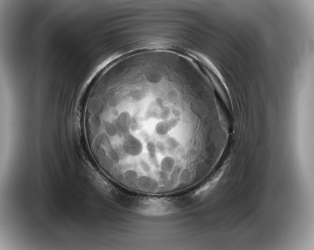 X0000087610835200704271339