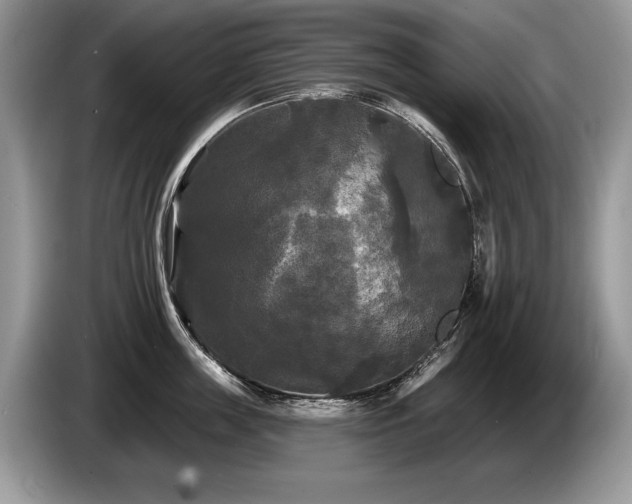 X0000087610859200704271339