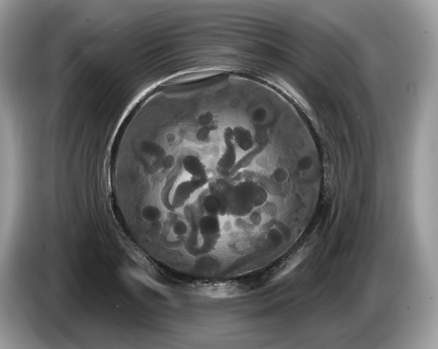 X0000087610891200704271338