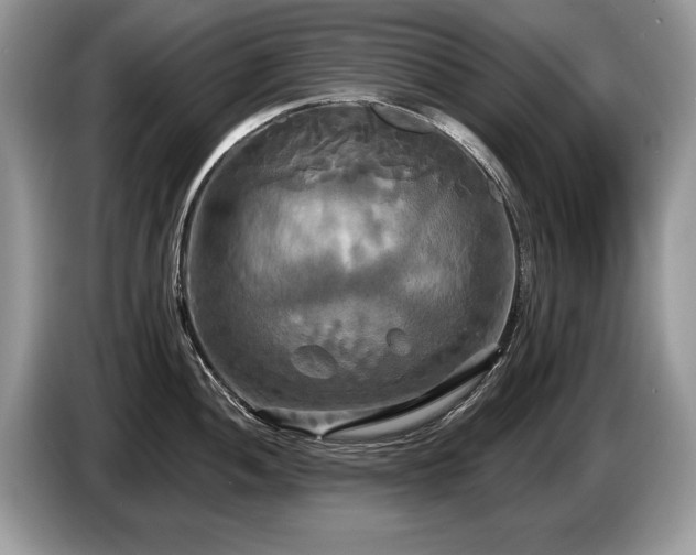 X0000087611052200704271337