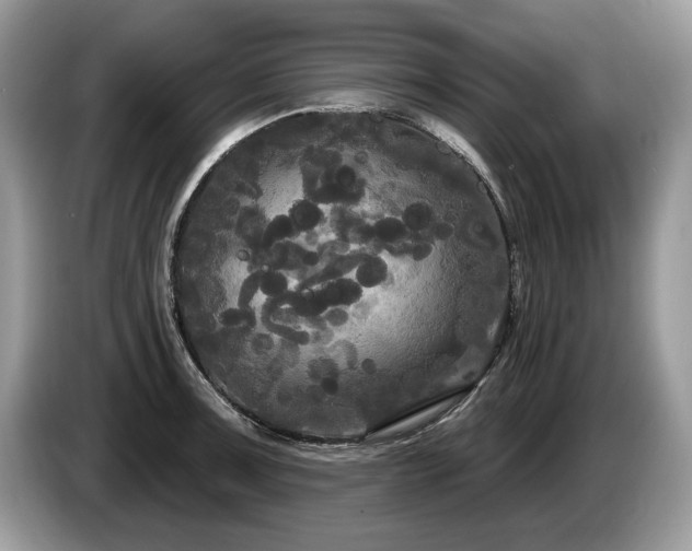 X0000087611091200704271336