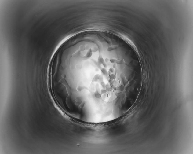 X0000087611103200704271336