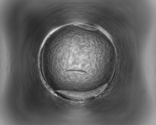 X0000087611104200704271336