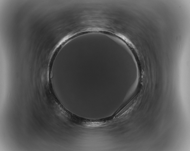 X0000087611173200704271335