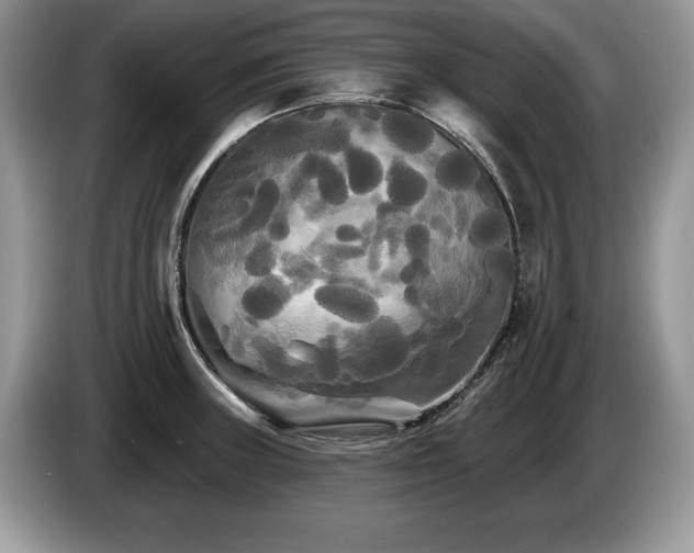X0000087611235200704271335