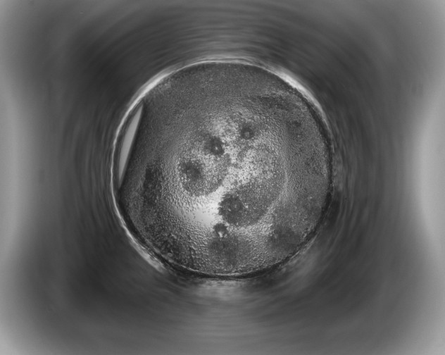 X0000087611237200704271335
