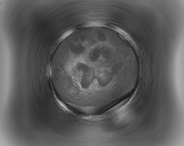 X0000087611241200704271335