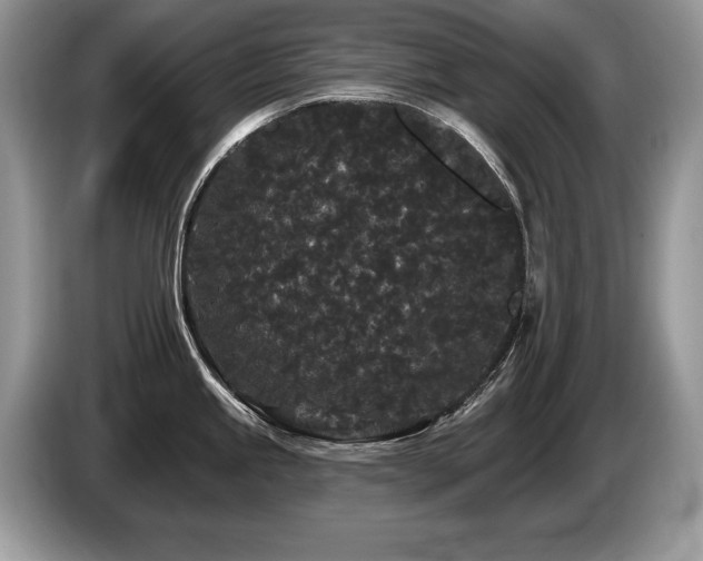X0000087611245200704271335