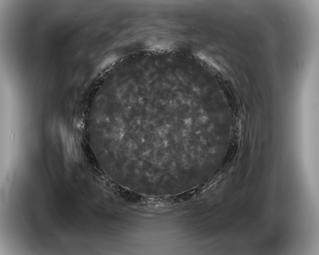 X0000087611254200704271334