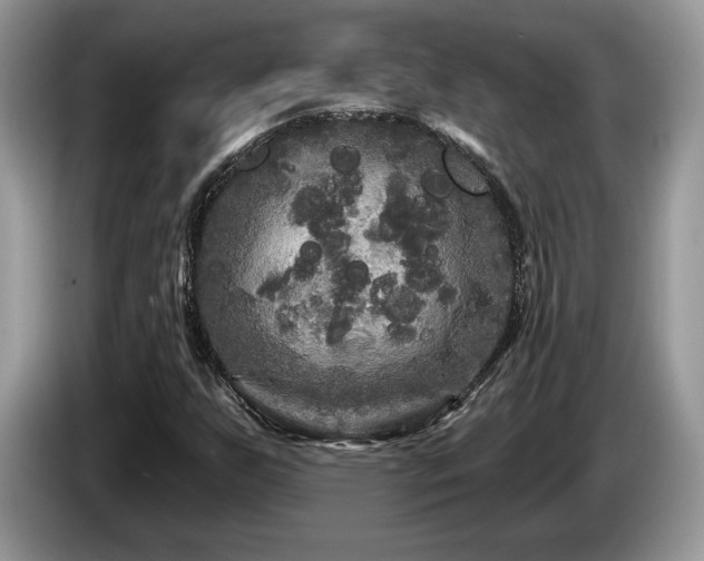 X0000087611255200704271334
